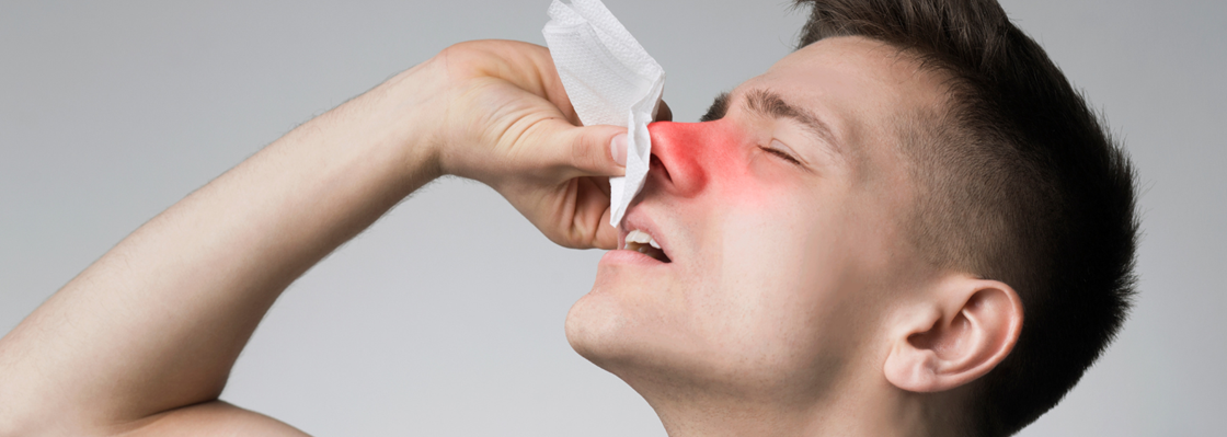 Sangue Dal Naso Ghiaccio Può Aiutare