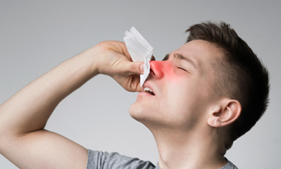 Sangue Dal Naso Ghiaccio Può Aiutare